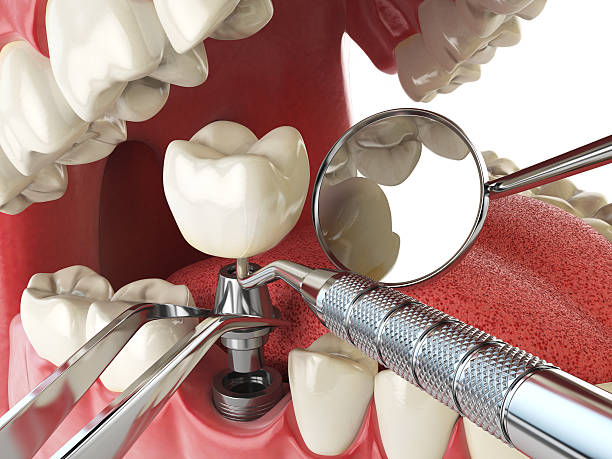 Best Emergency Treatment for Dental Infections or Abscesses in Orchard Grass Hills, KY